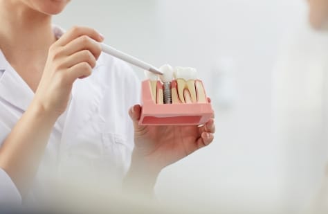 Dental implant consultation specia coupon