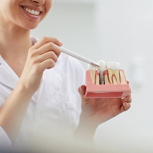 A dentist showing a patient a cross-section mold of a dental implant that exists between two health teeth