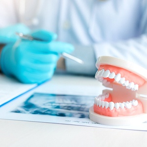 Model of dentures on table with paperwork and X-rays