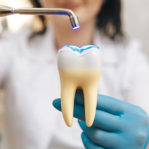Dentists curing woman’s composite resin dental filling with UV light
