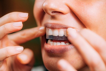 Patient placing whitening strip on their top teeth