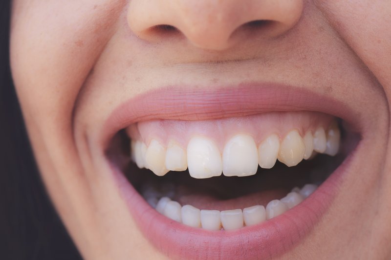 Woman with healthy gums