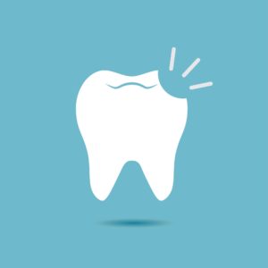 Illustration of a chipped tooth on a pale blue background